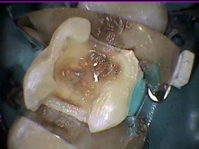 7 26 pdt wsd8u5 - Eugenol