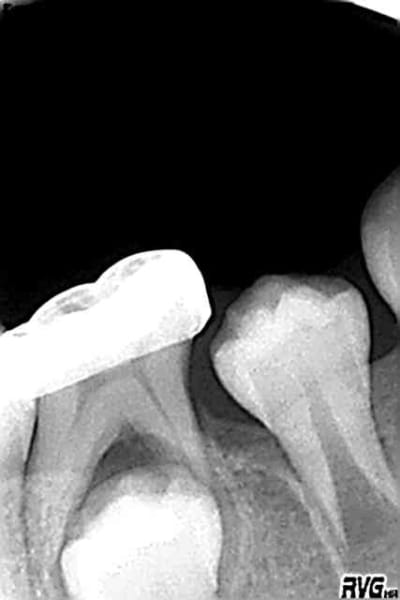 85 r1 sdywth - Eugenol