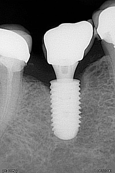 87kghbtv1160b0kbg816eshlu4d7 - Eugenol