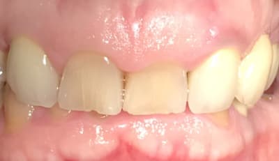 8a50cef2 0d65 427b ace1 d29708eb61eb bppc2x - Eugenol