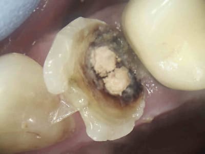 8 tovoto - Eugenol