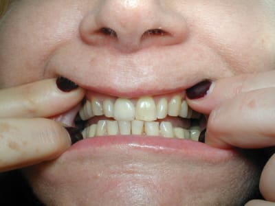 91120005 gml7nq - Eugenol