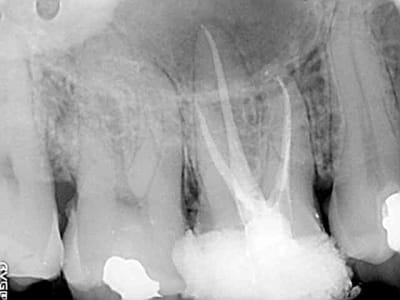 A16post obkelj - Eugenol