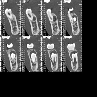 A18 j8jivd - Eugenol