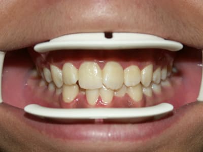 A1 nfqgqk - Eugenol