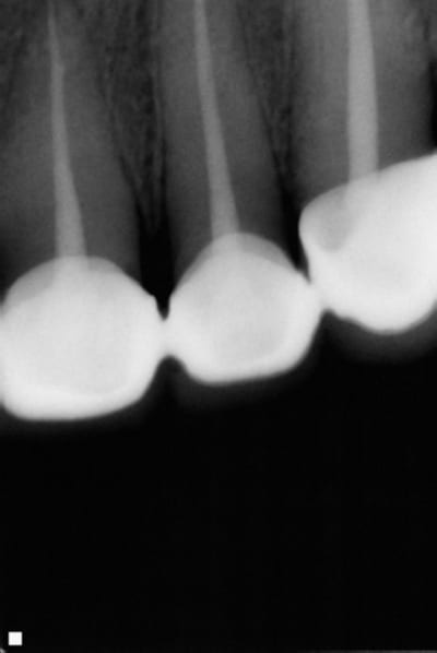 A34 ky9rfv - Eugenol