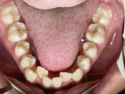 A6 g5dbbc - Eugenol