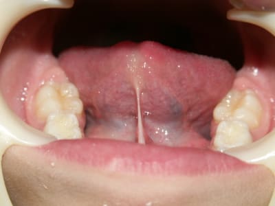 A9 d8lars - Eugenol