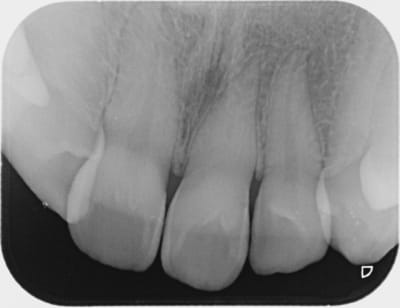 Ak anissa 000 l2iskm - Eugenol