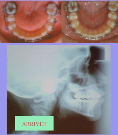 Arrivee  i12fof - Eugenol