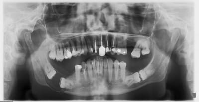 Atchoum qhyn7s - Eugenol