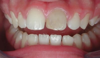 Avant gvbdb5 - Eugenol