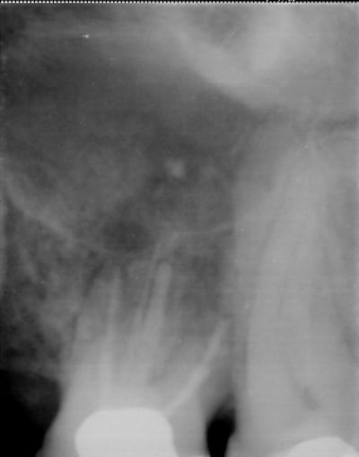 A 6 mois ncmyca - Eugenol