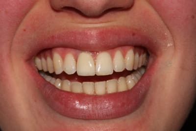 Apr s collage2 yfpsix - Eugenol