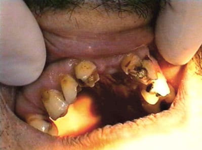 Avant haut jday3s - Eugenol