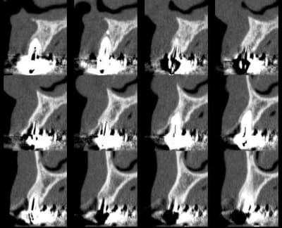 B0008 kmw6yr - Eugenol