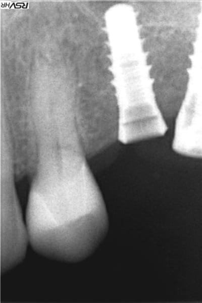 Bad1 c46k88 - Eugenol