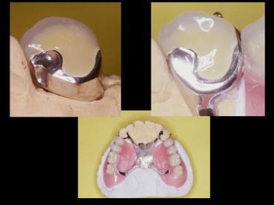 Buis 2 itzcci - Eugenol