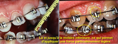 Beance1 sflapi - Eugenol