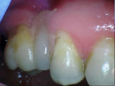 Bridge made in marocco 2 i0dba5 - Eugenol