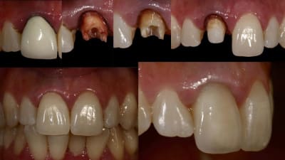 Cas olivier cmtwov - Eugenol