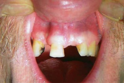 Chaudron015 pob3dh - Eugenol