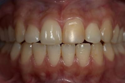 Crw 0537  large  kk2atl - Eugenol