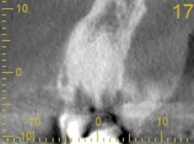 Cs 20131209 0838 17 mhlamm - Eugenol