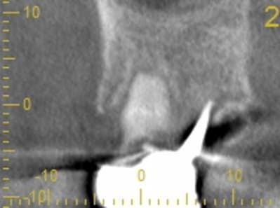 Cs 20131209 0838 2 c1cged - Eugenol