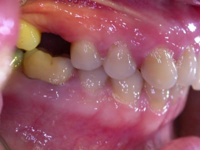 C dscn1688 wi5mz1 - Eugenol