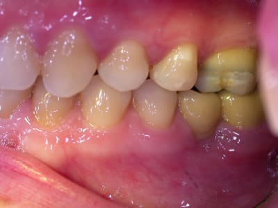 C dscn1690 d031zp - Eugenol