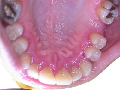 C dscn1691 m0slig - Eugenol