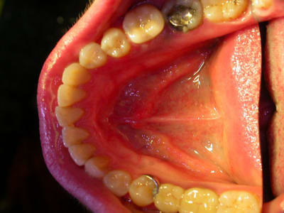 C dscn1692 xfogic - Eugenol