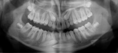 Canines 14 ans a  qrvcnb - Eugenol