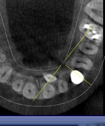 Capture2 nmckof - Eugenol