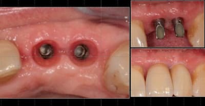 Capture 2 splmty - Eugenol
