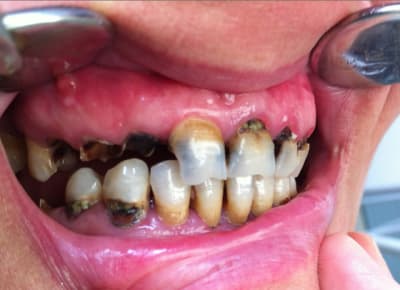 Capture d  cran 2014 02 09   00.53 - Eugenol