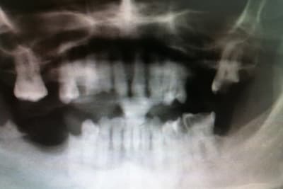 Capture d  cran 2014 02 09   00.54 - Eugenol