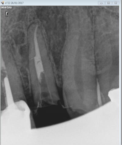 Capture d écran 2017 01 26 19.39 - Eugenol
