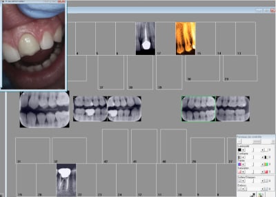 Capture d écran 2017 07 21 21.11 - Eugenol