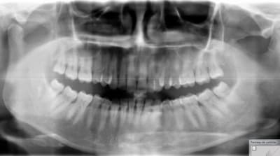 Capture d e cran 2015 04 23 17.26 - Eugenol