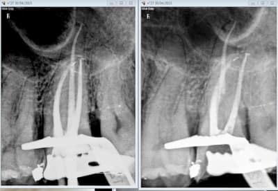 Capture d e cran 2015 04 30 23.13 - Eugenol