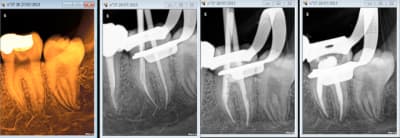 Capture d e cran 2015 07 29 14.32 - Eugenol