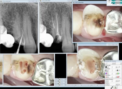 Capture d e cran 2016 04 12 11.33 - Eugenol