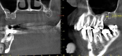 Capture fwbwzb - Eugenol