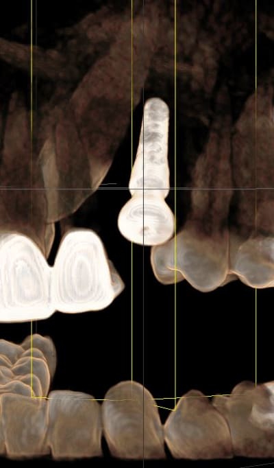 Capture gbexnw - Eugenol