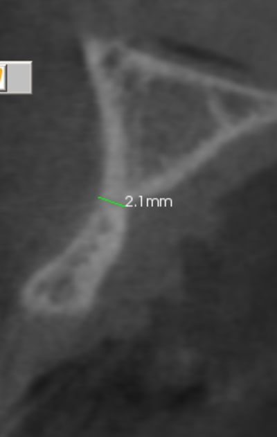 Capture gly2p4 - Eugenol