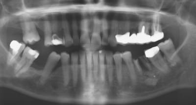 Capture huwovq - Eugenol
