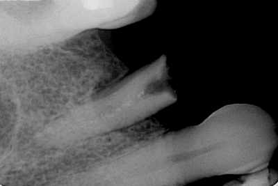 Capture o4g5qo - Eugenol