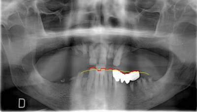 Capture sbra6u - Eugenol